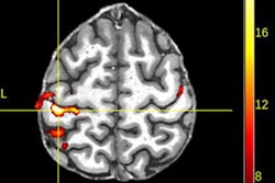 2020 08 10 21 06 5281 2020 08 10 Ge Figure 1 Signa 7t 20200810212017
