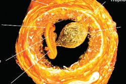 2020 08 12 22 02 9775 Ectopic 1 400
