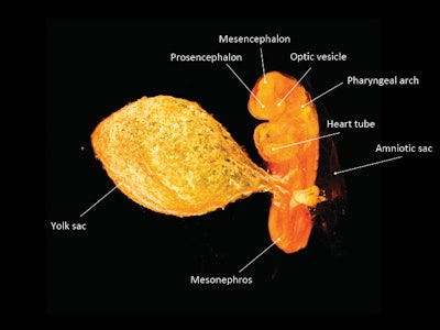 The embryo is shown from the ventral side, with the developing heart tube facing the viewer. Various organs are denoted. Image courtesy of the RSNA.