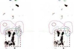 2020 08 12 22 20 8906 2020 08 13 Snmmi Radiation Dose 20200812222205 20200812222353