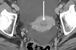 2020 08 18 23 49 6253 2020 08 19 Rad Errors Ct Exams Figure4 20200819151529