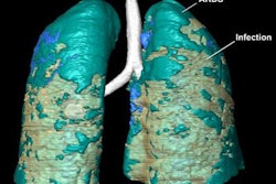 2020 08 19 21 29 6033 2020 08 20 Covid 3 D 20200819214319