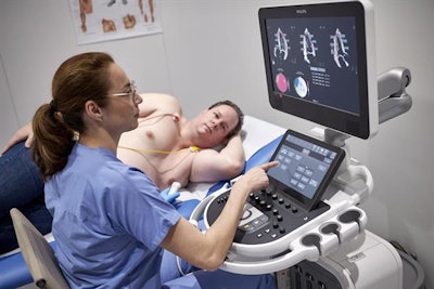 Philips is launching the Affiniti CVx scanner at ESC 2020.