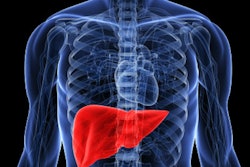 2017 03 06 17 07 58 262 Man Liver 400