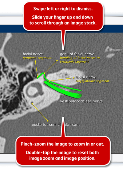 Radiology Assistant 2.0. Image courtesy of Dr. Wouter Veldhuis, PhD.