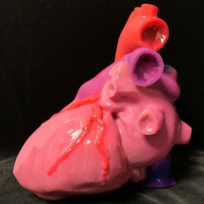 An individually tailored, multicolor 3D-printed heart. Image courtesy of Summer Decker, PhD.