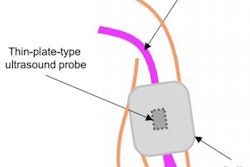 2020 08 31 23 11 1348 2020 09 01 Blood Pressure Cuff Illustration 20200831234129