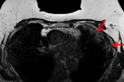 2020 09 02 21 55 7692 2020 09 01 Rcr Mr Axial Image 1 20200902211918