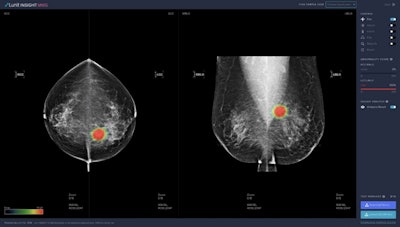 Lunit's Insight MMG AI software for breast cancer detection. Image courtesy of Lunit.