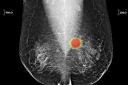 2020 09 10 21 06 6147 2020 09 10 Lunit Mammo 20200910210428