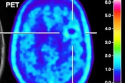 2020 09 11 23 40 2891 2020 09 14 Fet Pet Brain Metastasis Jnm 20200911230905