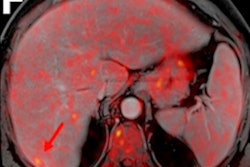 2020 09 17 20 27 1751 2020 09 17 Snmmi Pet Mri Image F