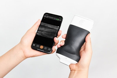 Clarius L20 HD handheld ultrasound scanner is designed to provide extremely high image quality for shallow anatomy. Image courtesy of Clarius.