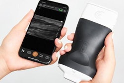 2020 09 22 20 49 9180 2020 09 22 Clarius L20 20200922201409