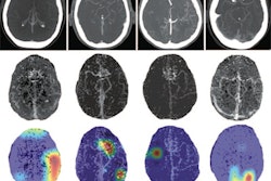 2020 09 29 16 20 8411 2020 09 29 Radiology Ai Stroke Stib
