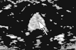 2020 09 29 23 48 1781 2020 09 30 Rad Imaging Cancer Elfatairy Figure2 20200930070149