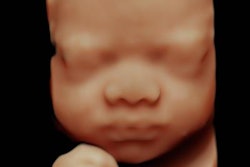 2020 09 30 17 58 6560 2020 09 30 Ge Voluson H Dlive Fetal Face 20200930173343