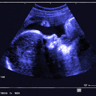2019 04 15 23 11 1614 Fetal Ultrasound 400