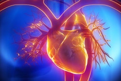 2019 06 11 22 35 5932 Heart Pulmonary Trunk 400