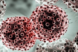 2020 06 26 16 29 2945 Cancer Lung 400