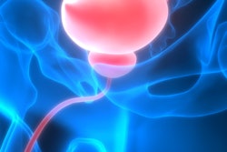 2020 10 09 19 56 6173 Bladder Urinary 3 D 400