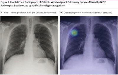 Image courtesy of Lunit.