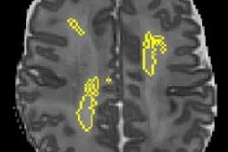2020 10 16 23 45 7845 2020 10 20 Quantitative Mri 20201016235136