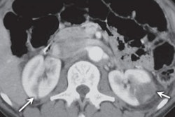 2020 10 19 20 46 5840 2020 10 19 Ct Abdominal Imaging Drug Use Figure10 400