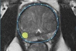 2020 10 20 18 29 1638 2020 10 20 Ezra 3 D Prostate Lesion Ai 20201020184140