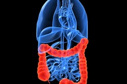 2020 10 20 20 28 6183 Colon 400
