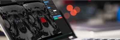 Quantib's prostate AI software features a suite of tools aimed at improving radiologist performance in assessing prostate MRI exams.