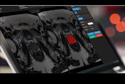 2020 10 21 01 09 2843 2020 10 21 Quantib 400