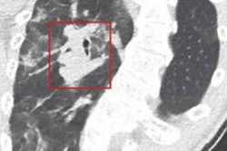 2020 10 21 19 47 0920 2020 10 22 Ajr Spectral Ct 1 20201021192816