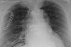 2020 10 22 20 38 4257 2020 10 22 Mri Implants Figure4 20201022205322