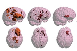 2020 10 23 20 32 2509 2020 10 23 Mri Brain 400