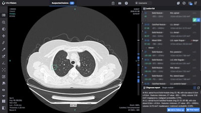 InferRead Lung CT.AI is designed to aid radiologists in detecting pulmonary nodules on chest CT. Image courtesy of Infervision.