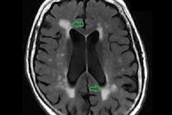 2020 10 26 22 14 7779 2020 10 27 White Matter 2 400