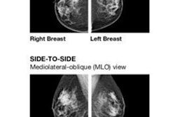 2020 10 26 22 15 0289 2020 10 26 Volpara Project Thumb 20201026222145