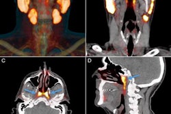 2020 10 27 18 58 4429 2020 10 27 Salivary Glands 1 20201027183608