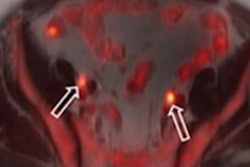 2020 10 27 20 13 5656 2020 10 27 Ajr Pet Mri 20201027203041