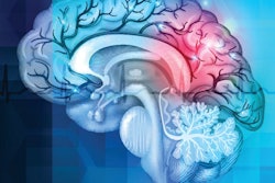 2020 06 19 23 19 7240 Brain Abstract 400