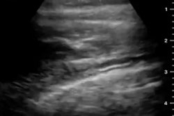 2020 11 02 18 38 7896 2020 11 10 Ultrasound Preview Chen2 400
