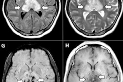 2020 11 04 00 07 7815 2020 04 01 Covid Encephalophathy 2 A 2 H 400