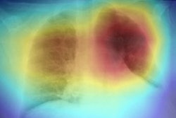 2020 11 05 23 02 4945 Road X Ray Ai Algorithm