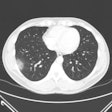 2020 11 12 22 05 2505 2020 05 15 Non Chest Ct Covid Figure 4 400