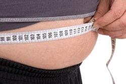 2020 11 16 23 20 0191 Obesity 400