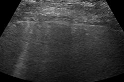 2020 11 17 00 29 0073 2020 11 16 Longhauler Ultrasound 20201117002408