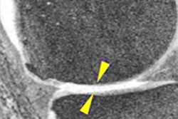 2020 11 17 01 17 7505 2020 11 17 Rsna Racket Sports Mri 20201117165655