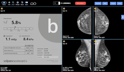 DensityED is an online training module designed to help radiologists improve their assessment of breast density on mammograms. Image courtesy of Volpara.