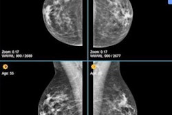 2020 11 17 18 46 9257 2020 11 17 Volpara 20201117182241